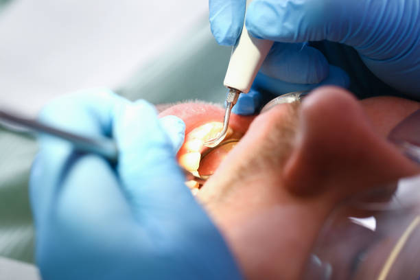 Best Emergency Gum Pain Relief  in Pleasant Gap, PA